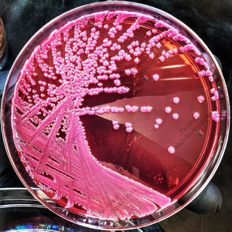 enterobacter macconkey|12.6.1: MacConkey Agar .